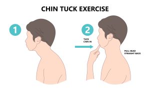 A cartoon person demonstrating the chin tuck exercise. 